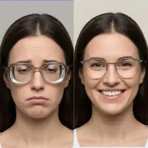 Demonstração técnica de lentes de grau de alto índice na Ótica Vision D'Or em Aracaju, destacando a espessura reduzida e nitidez.
